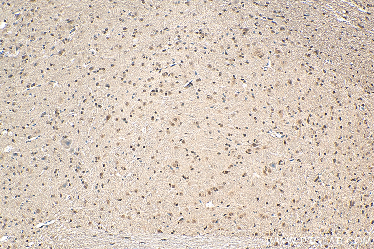 Immunohistochemistry (IHC) staining of mouse cerebellum tissue using L3MBTL3 Polyclonal antibody (28112-1-AP)