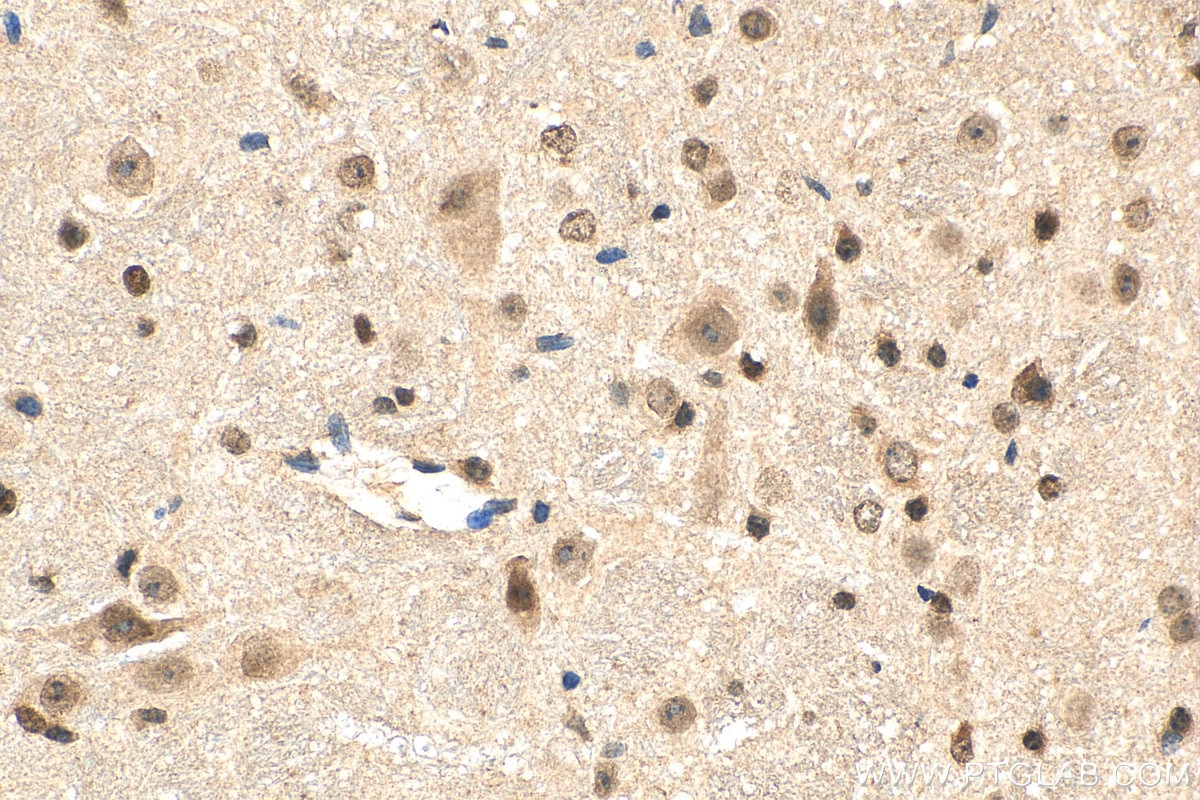 Immunohistochemistry (IHC) staining of mouse cerebellum tissue using L3MBTL3 Polyclonal antibody (28112-1-AP)