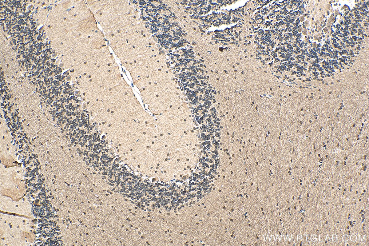 Immunohistochemistry (IHC) staining of mouse cerebellum tissue using L3MBTL3 Polyclonal antibody (28112-1-AP)