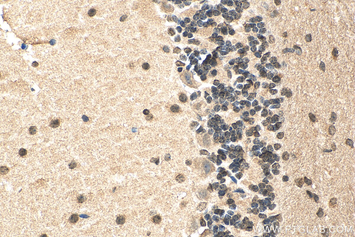 Immunohistochemistry (IHC) staining of mouse cerebellum tissue using L3MBTL3 Polyclonal antibody (28112-1-AP)