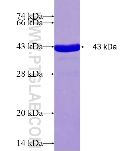 L3MBTL3 fusion protein Ag27136 SDS-PAGE