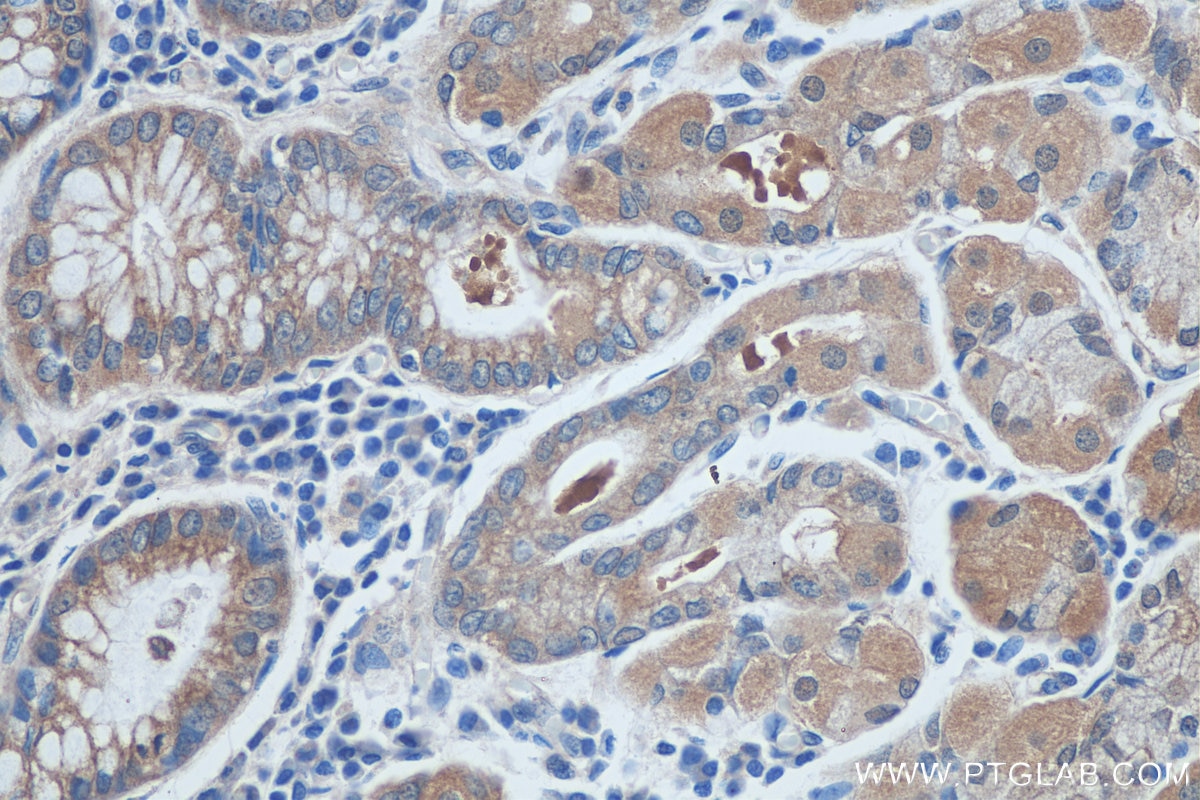 Immunohistochemistry (IHC) staining of human stomach tissue using L3MBTL4 Polyclonal antibody (26280-1-AP)