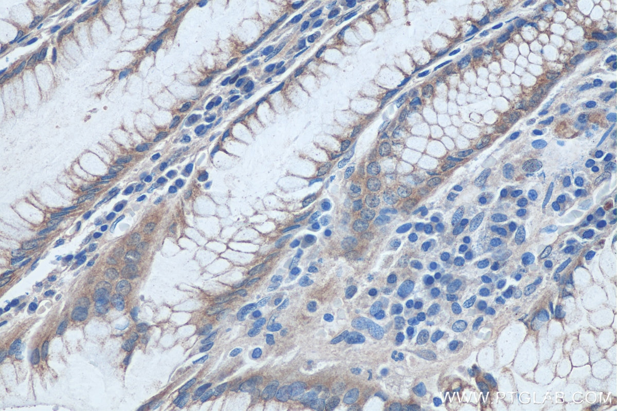 Immunohistochemistry (IHC) staining of human stomach tissue using L3MBTL4 Polyclonal antibody (26280-1-AP)