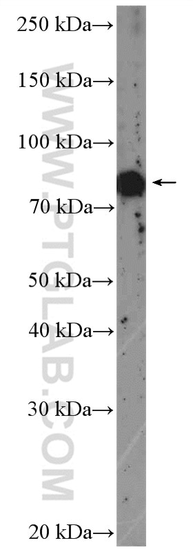 Western Blot (WB) analysis of mouse testis tissue using L3MBTL4 Polyclonal antibody (26280-1-AP)