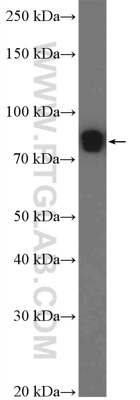 Western Blot (WB) analysis of mouse testis tissue using L3MBTL4 Polyclonal antibody (26280-1-AP)