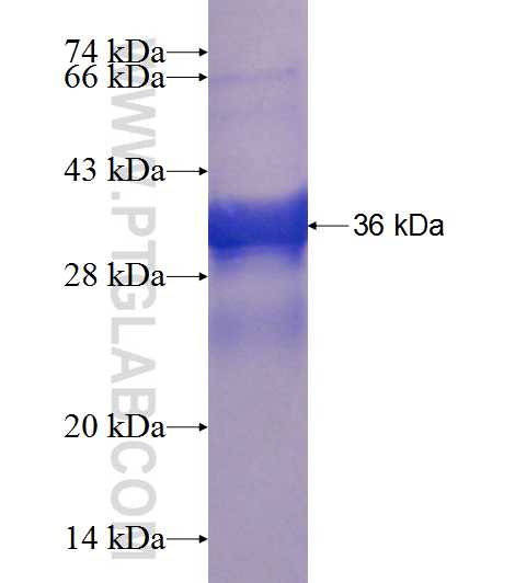 L3MBTL4 fusion protein Ag23588 SDS-PAGE
