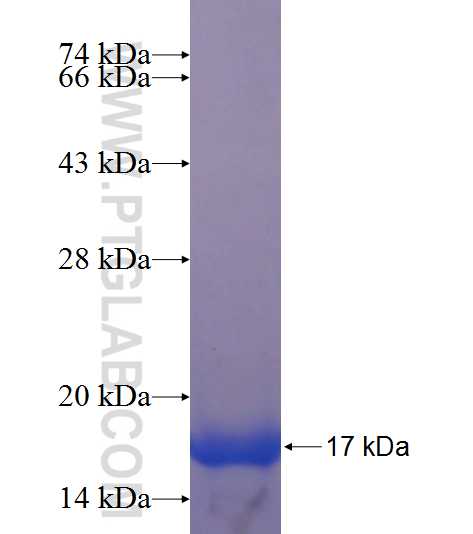 L3MBTL4 fusion protein Ag23637 SDS-PAGE