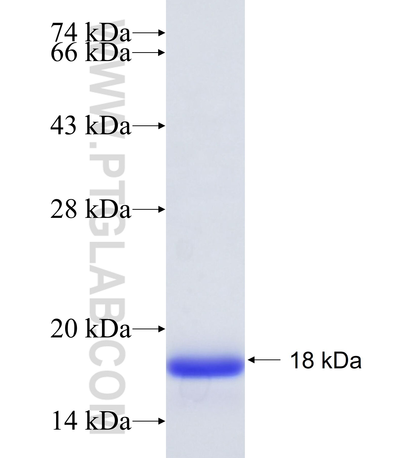 L3MBTL4 fusion protein Ag34257 SDS-PAGE