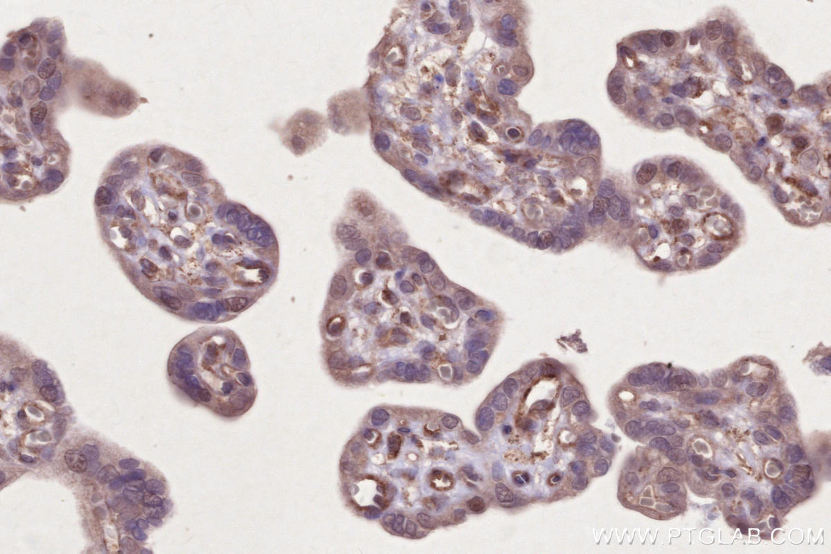 IHC staining of human placenta using 27895-1-AP Immunohistochemistry (IHC) staining of human placenta tissue using LACC1 Polyclonal antibody (27895-1-AP)