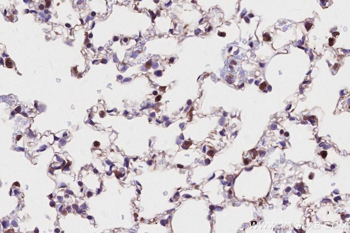 IHC staining of mouse lung using 27895-1-AP Immunohistochemistry (IHC) staining of mouse lung tissue using LACC1 Polyclonal antibody (27895-1-AP)