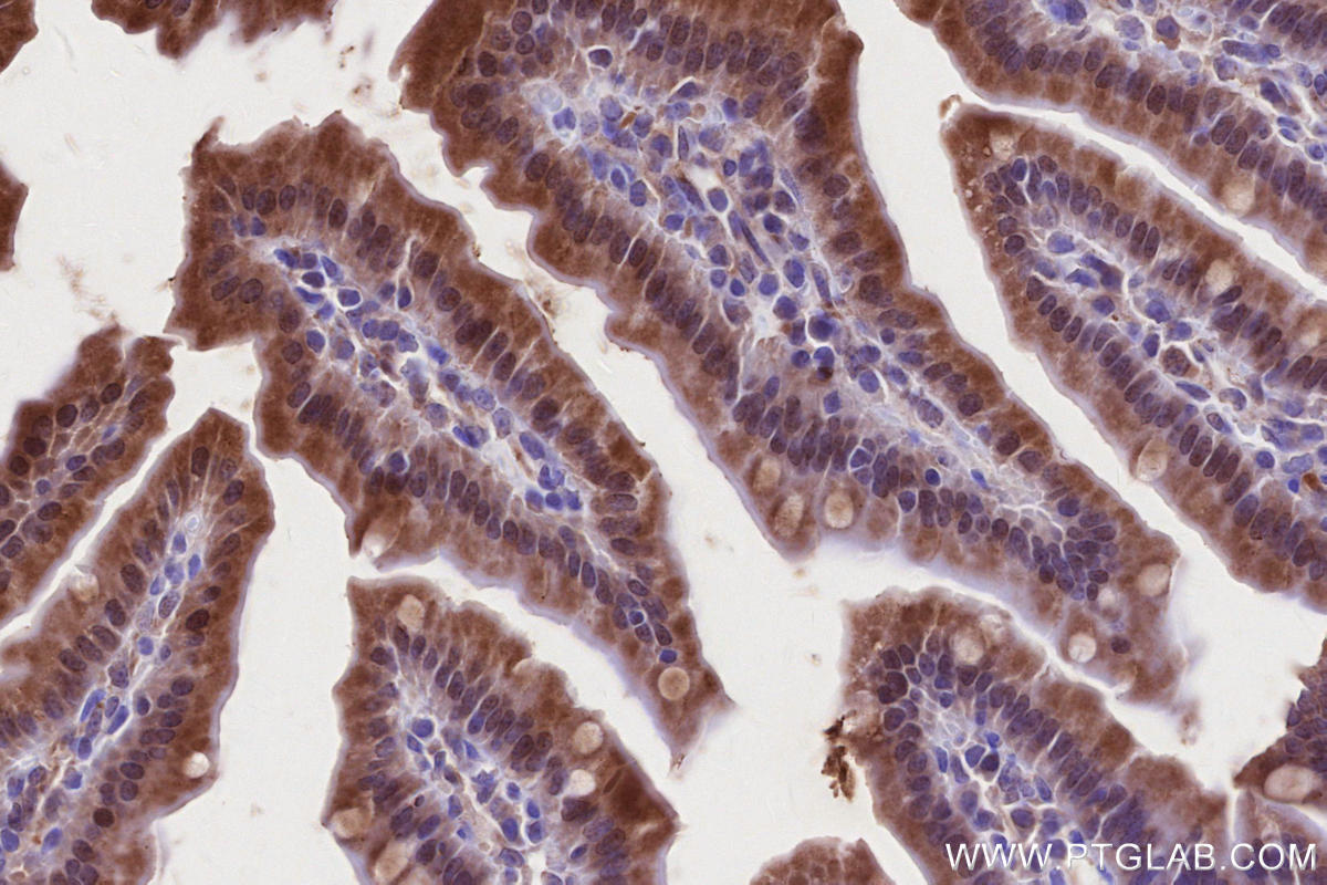 IHC staining of mouse small intestine using 27895-1-AP Immunohistochemistry (IHC) staining of mouse small intestine tissue using LACC1 Polyclonal antibody (27895-1-AP)