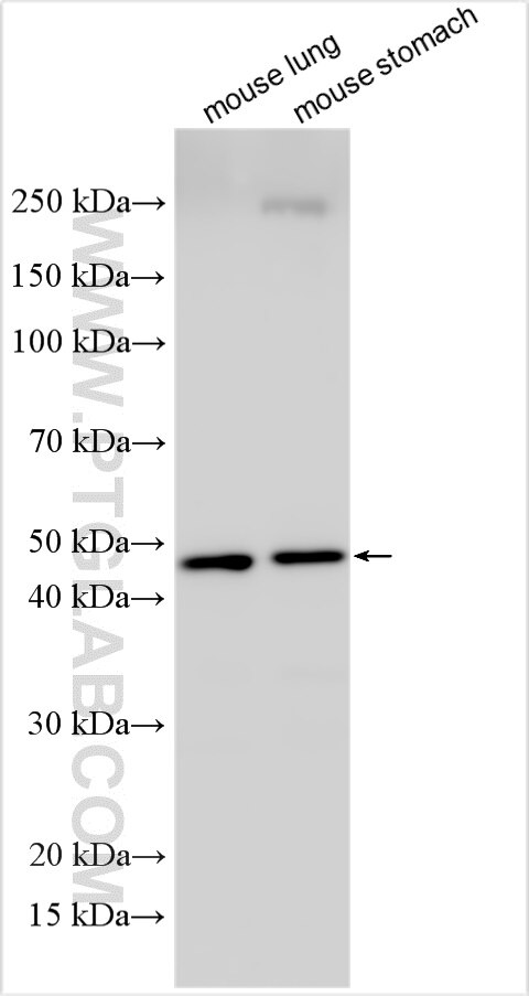 Western Blot (WB) analysis of various lysates using LACC1 Polyclonal antibody (27895-1-AP)