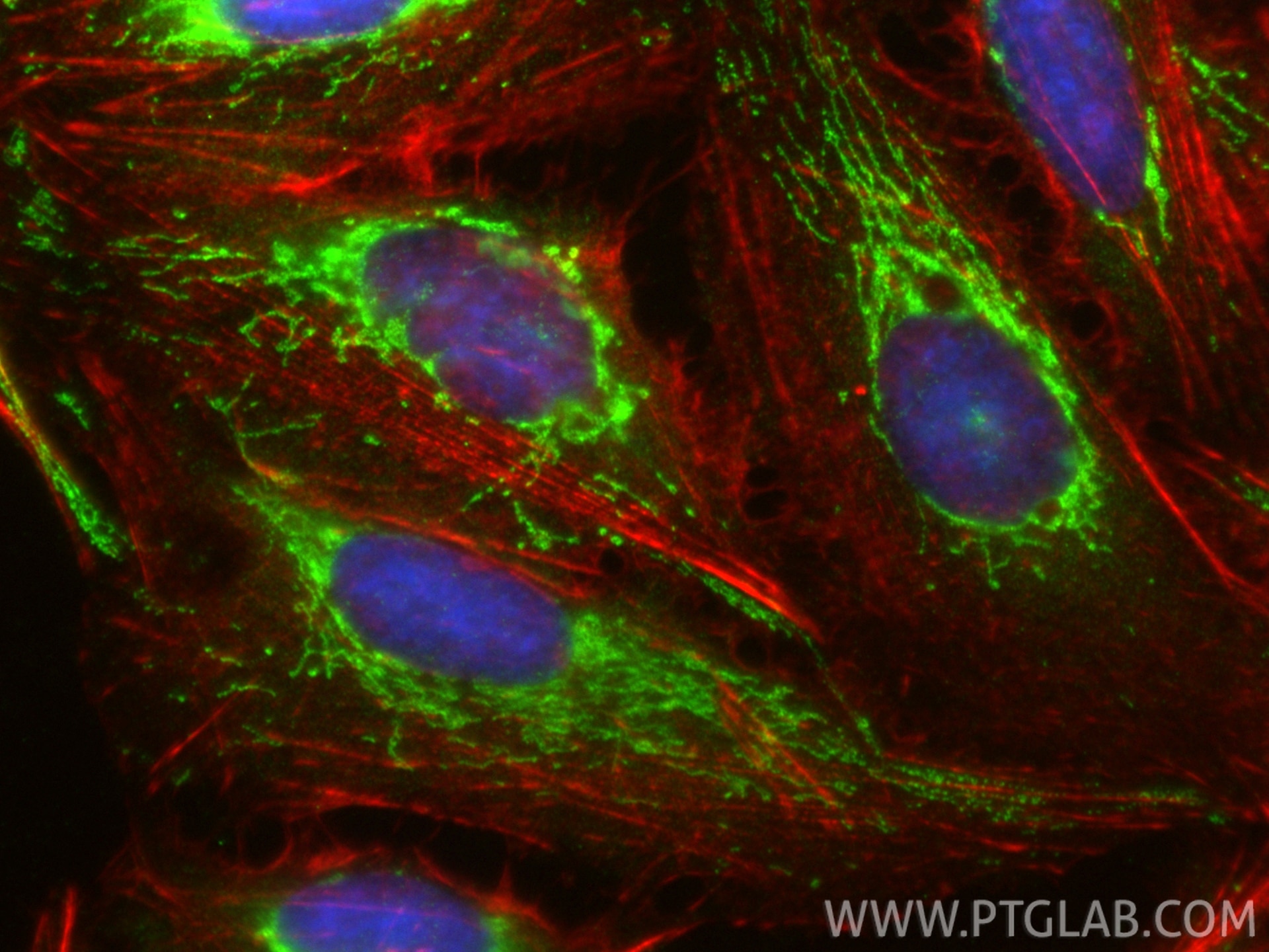 Immunofluorescent analysis of (-20°C Ethanol) fixed U2OS cells using LACE1 antibody (30157-1-AP) at dilution of 1:200 and CoraLite®488-Conjugated Goat Anti-Rabbit IgG(H+L) (SA00013-2), CL594-phalloidin (red). This data was developed using the same antibody clone with 30157-1-PBS in a different storage buffer formulation. Immunofluorescence (IF) / fluorescent staining of U2OS cells using LACE1 Polyclonal antibody (30157-1-AP)