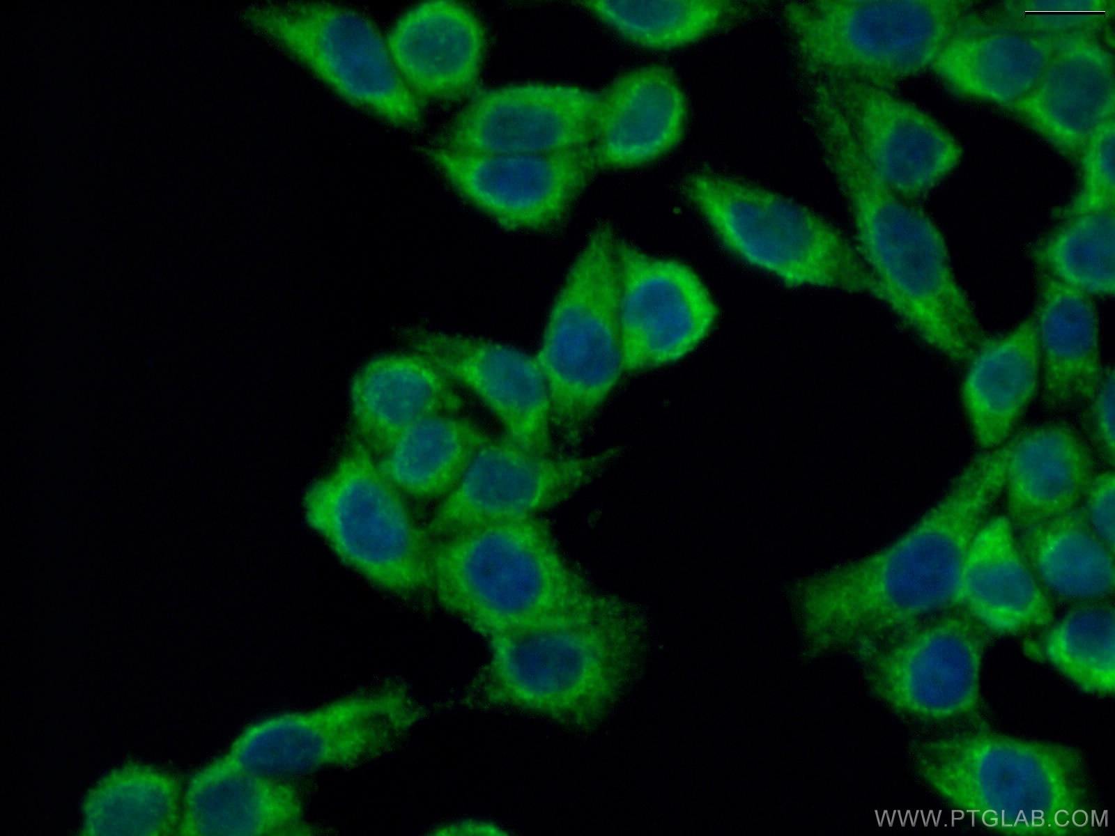 Immunofluorescence (IF) / fluorescent staining of HeLa cells using LACTB Polyclonal antibody (18195-1-AP)