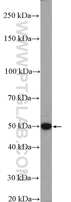 Western Blot (WB) analysis of HeLa cells using LACTB Polyclonal antibody (18195-1-AP)