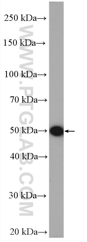 Western Blot (WB) analysis of HepG2 cells using LACTB Polyclonal antibody (18195-1-AP)