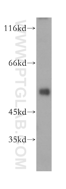 Western Blot (WB) analysis of human heart tissue using LACTB Polyclonal antibody (18195-1-AP)