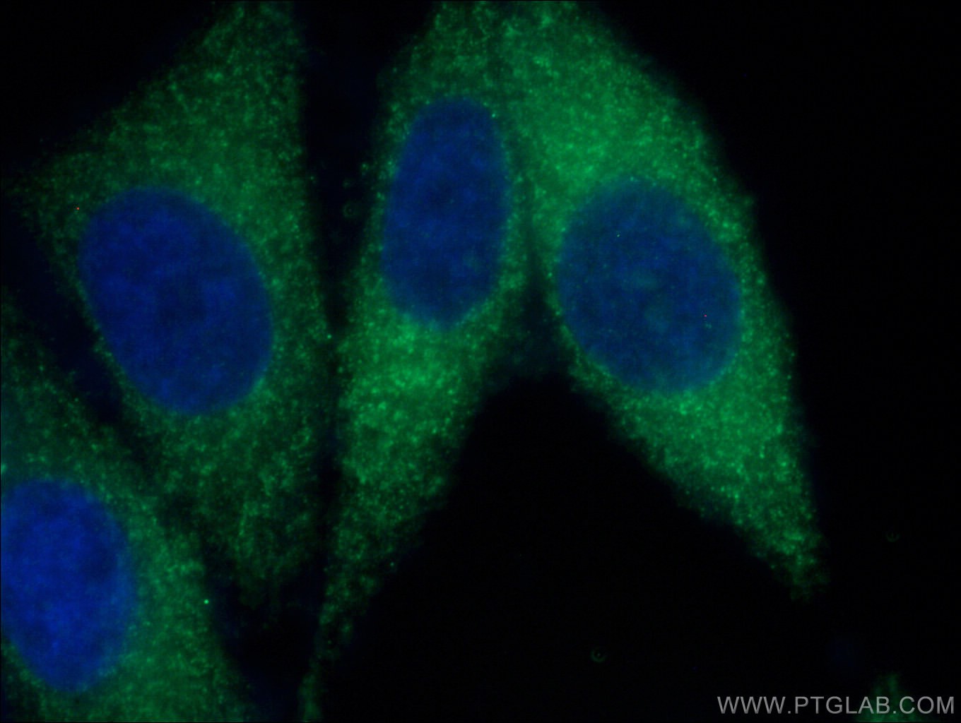 Immunofluorescence (IF) / fluorescent staining of HepG2 cells using LACTB Monoclonal antibody (66785-1-Ig)