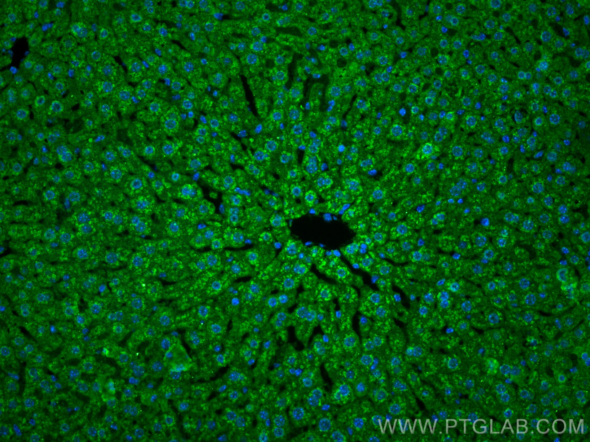 Immunofluorescence (IF) / fluorescent staining of mouse liver tissue using LACTB Monoclonal antibody (66785-1-Ig)