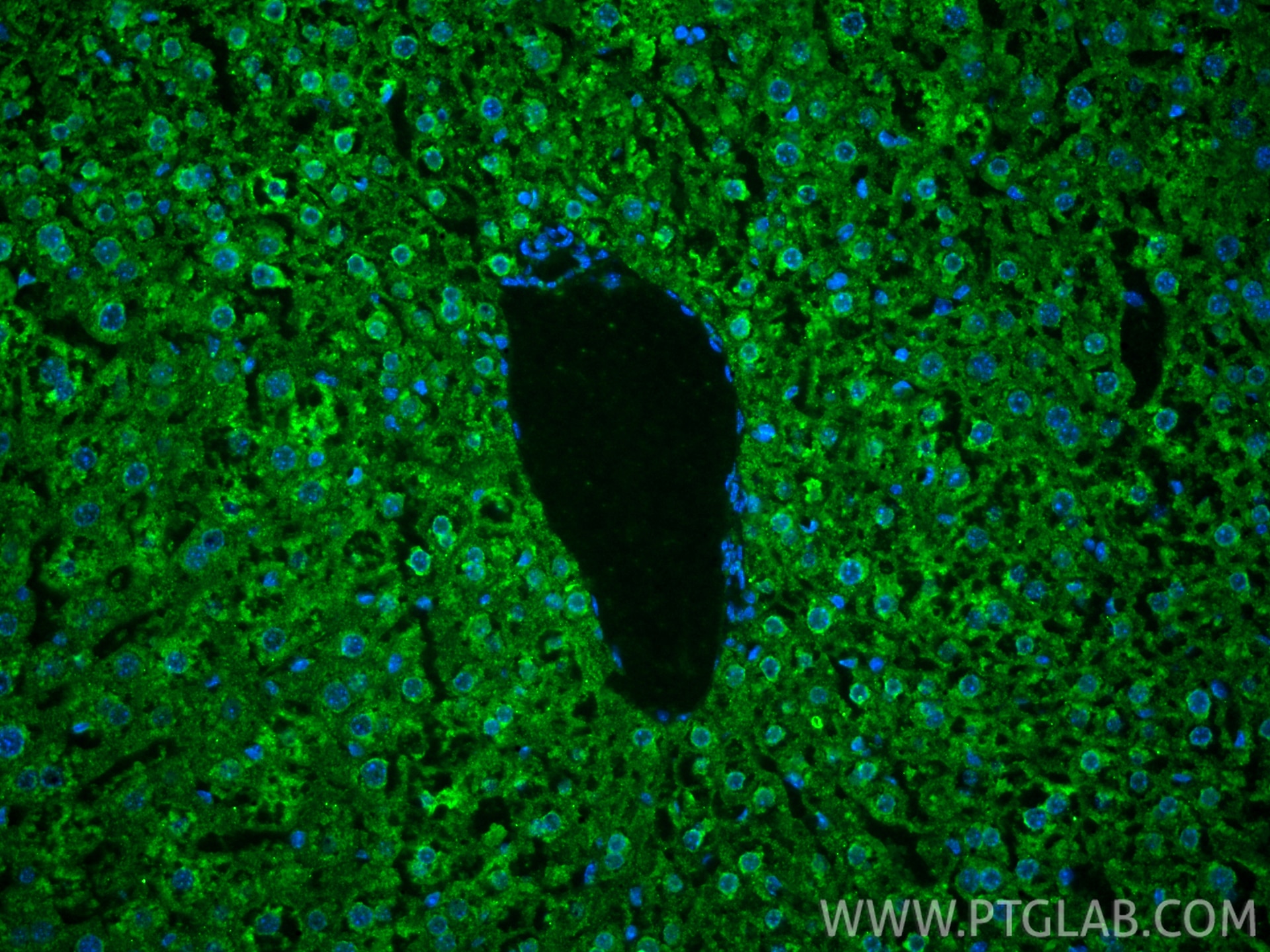Immunofluorescence (IF) / fluorescent staining of mouse liver tissue using LACTB Monoclonal antibody (66785-1-Ig)
