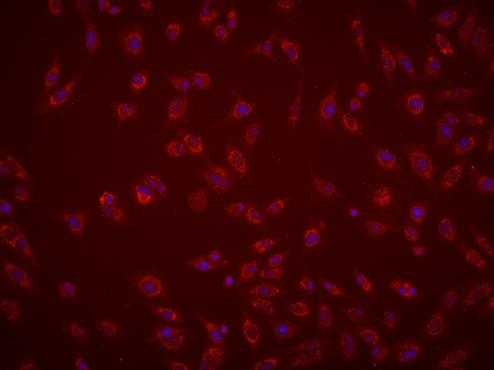 Immunofluorescence (IF) / fluorescent staining of A549 cells using LACTB Monoclonal antibody (66785-1-Ig)