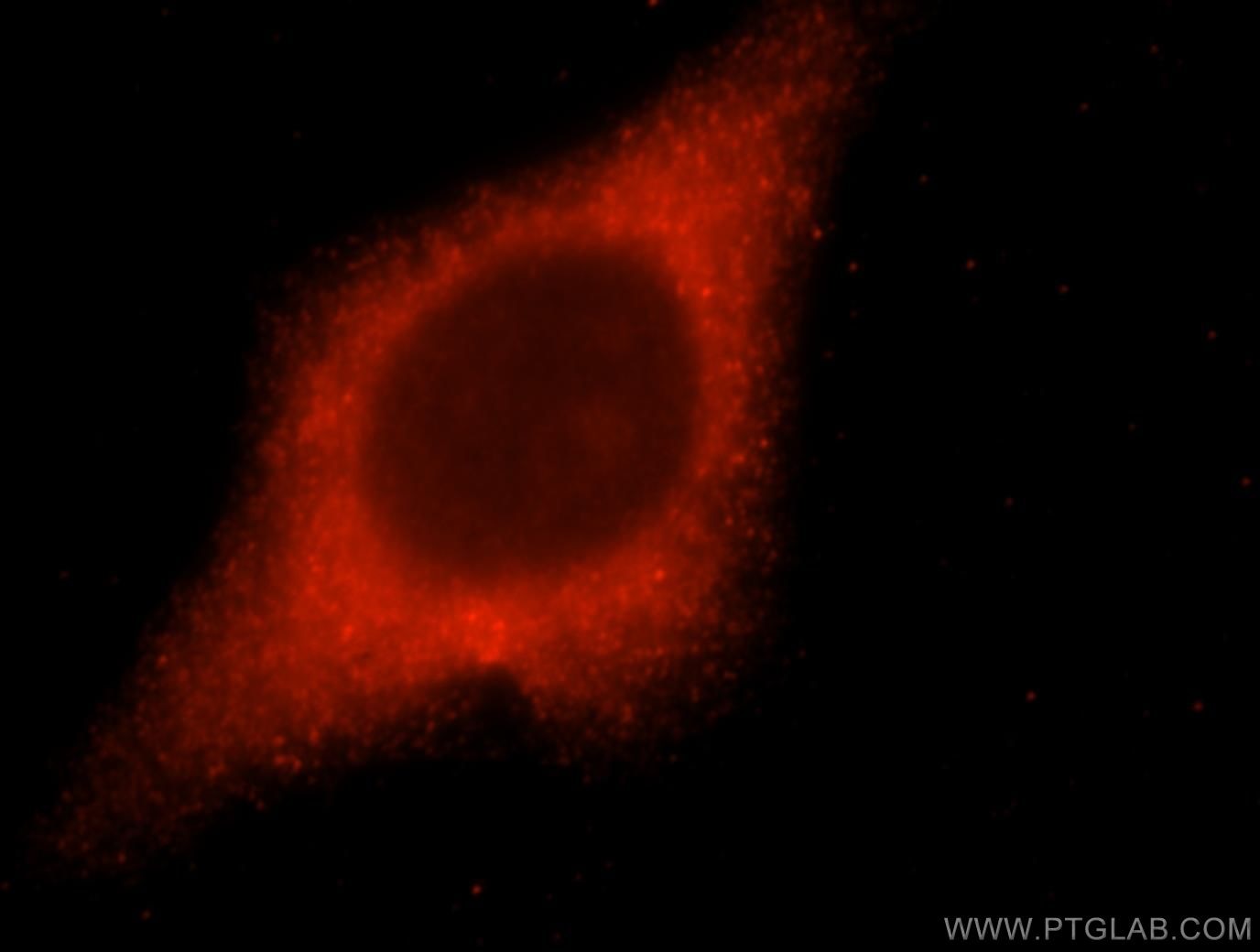 Immunofluorescence (IF) / fluorescent staining of HepG2 cells using LACTB2 Polyclonal antibody (16783-1-AP)