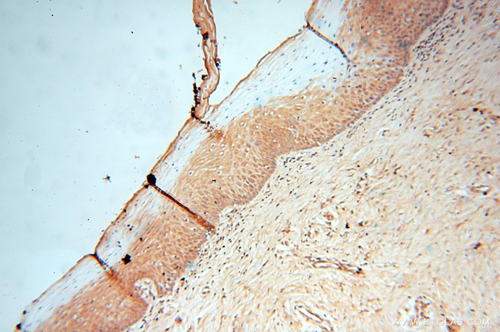 IHC staining of human cervix using 16783-1-AP