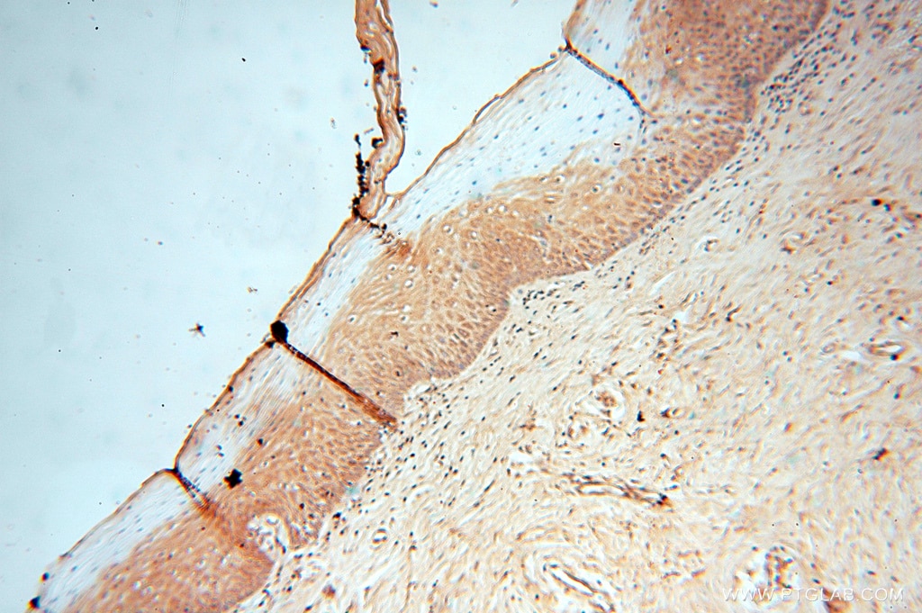 Immunohistochemistry (IHC) staining of human cervix tissue using LACTB2 Polyclonal antibody (16783-1-AP)