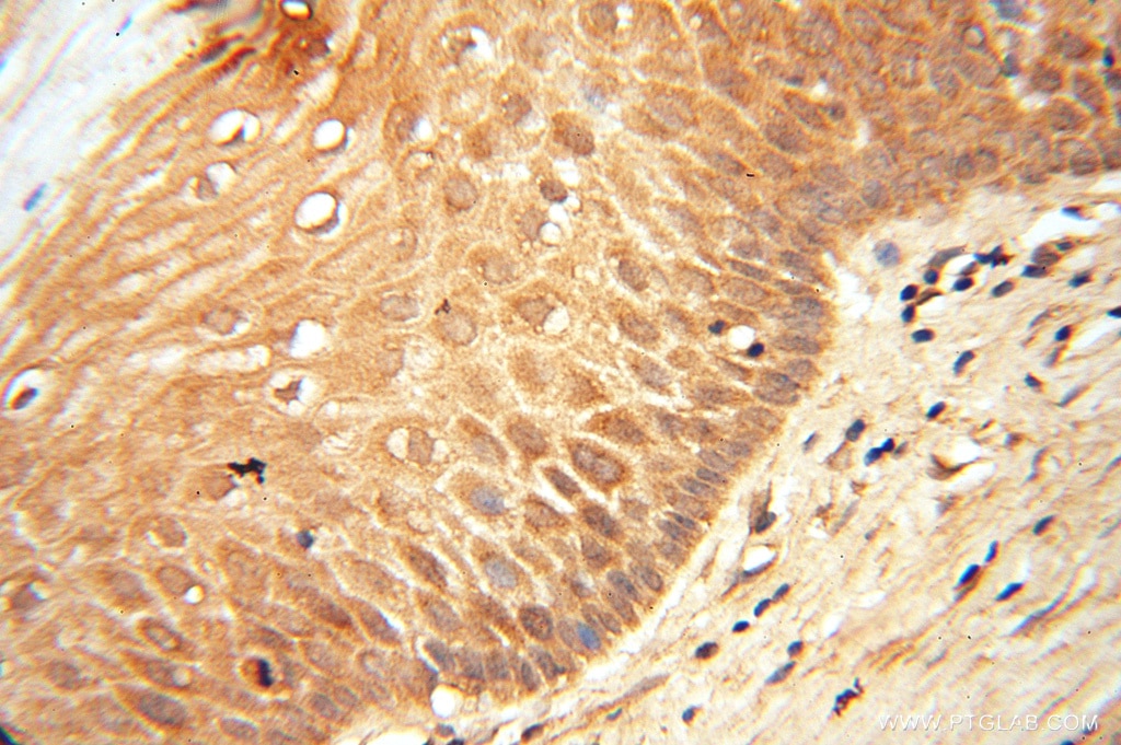 Immunohistochemistry (IHC) staining of human cervix tissue using LACTB2 Polyclonal antibody (16783-1-AP)