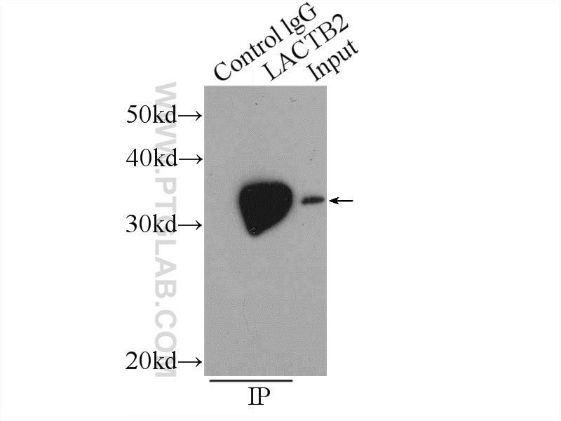 Immunoprecipitation (IP) experiment of A549 cells using LACTB2 Polyclonal antibody (16783-1-AP)