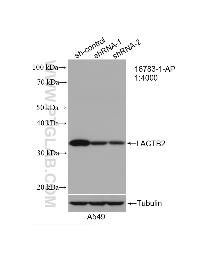 Western Blot (WB) analysis of A549 cells using LACTB2 Polyclonal antibody (16783-1-AP)
