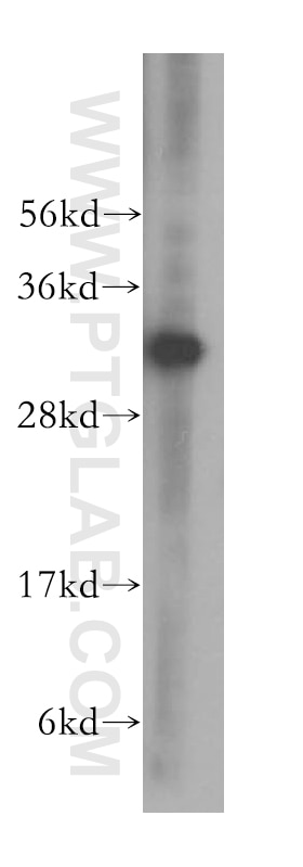 Western Blot (WB) analysis of PC-3 cells using LACTB2 Polyclonal antibody (16783-1-AP)
