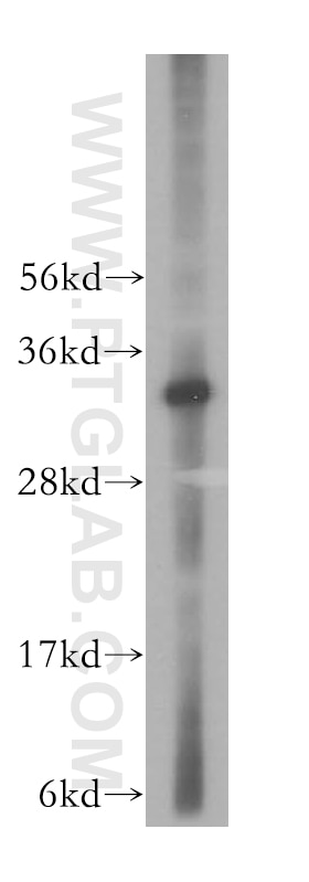 Western Blot (WB) analysis of Y79 cells using LACTB2 Polyclonal antibody (16783-1-AP)