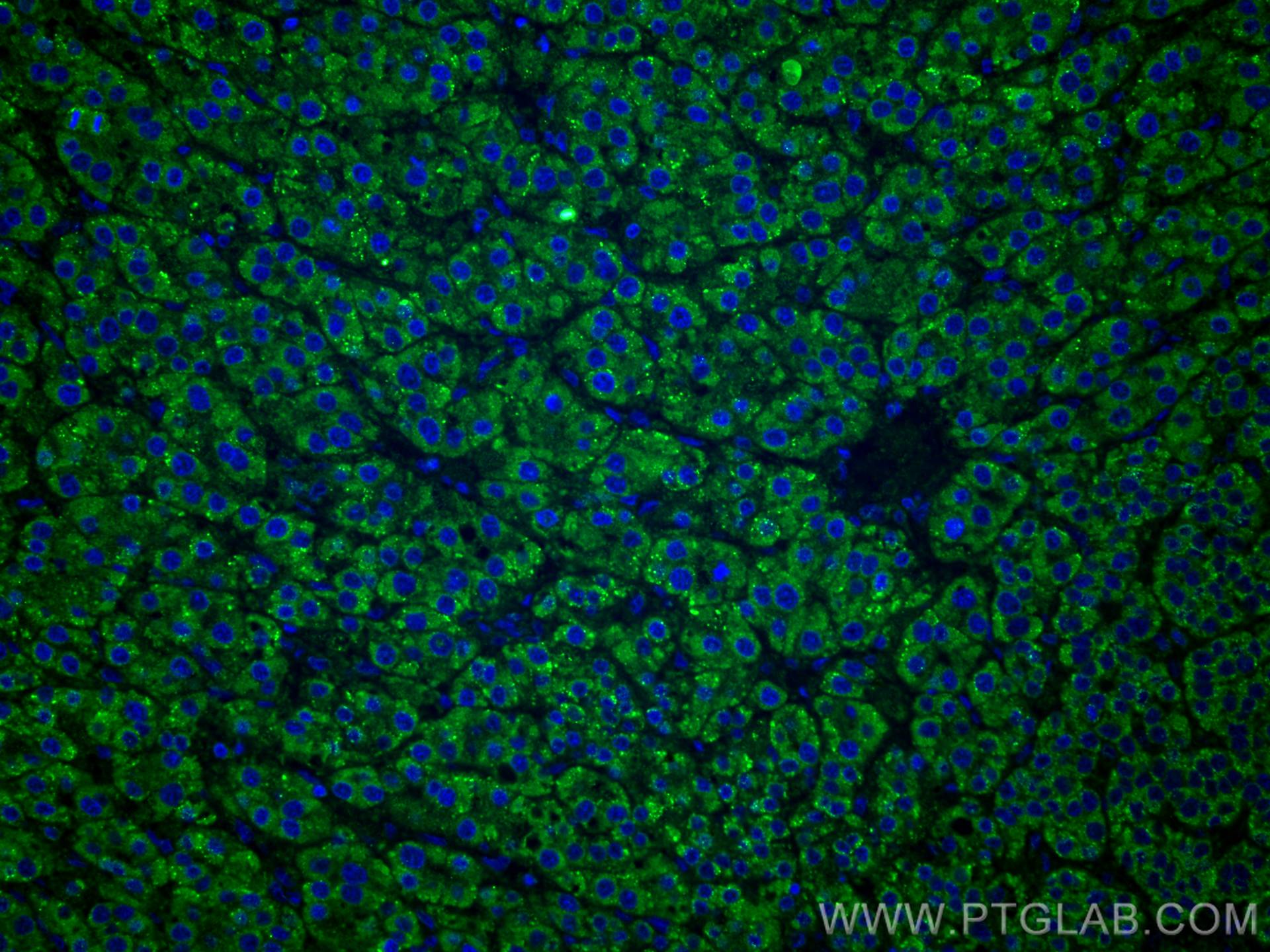 Immunofluorescence (IF) / fluorescent staining of human liver cancer tissue using LACTB2 Monoclonal antibody (67399-1-Ig)