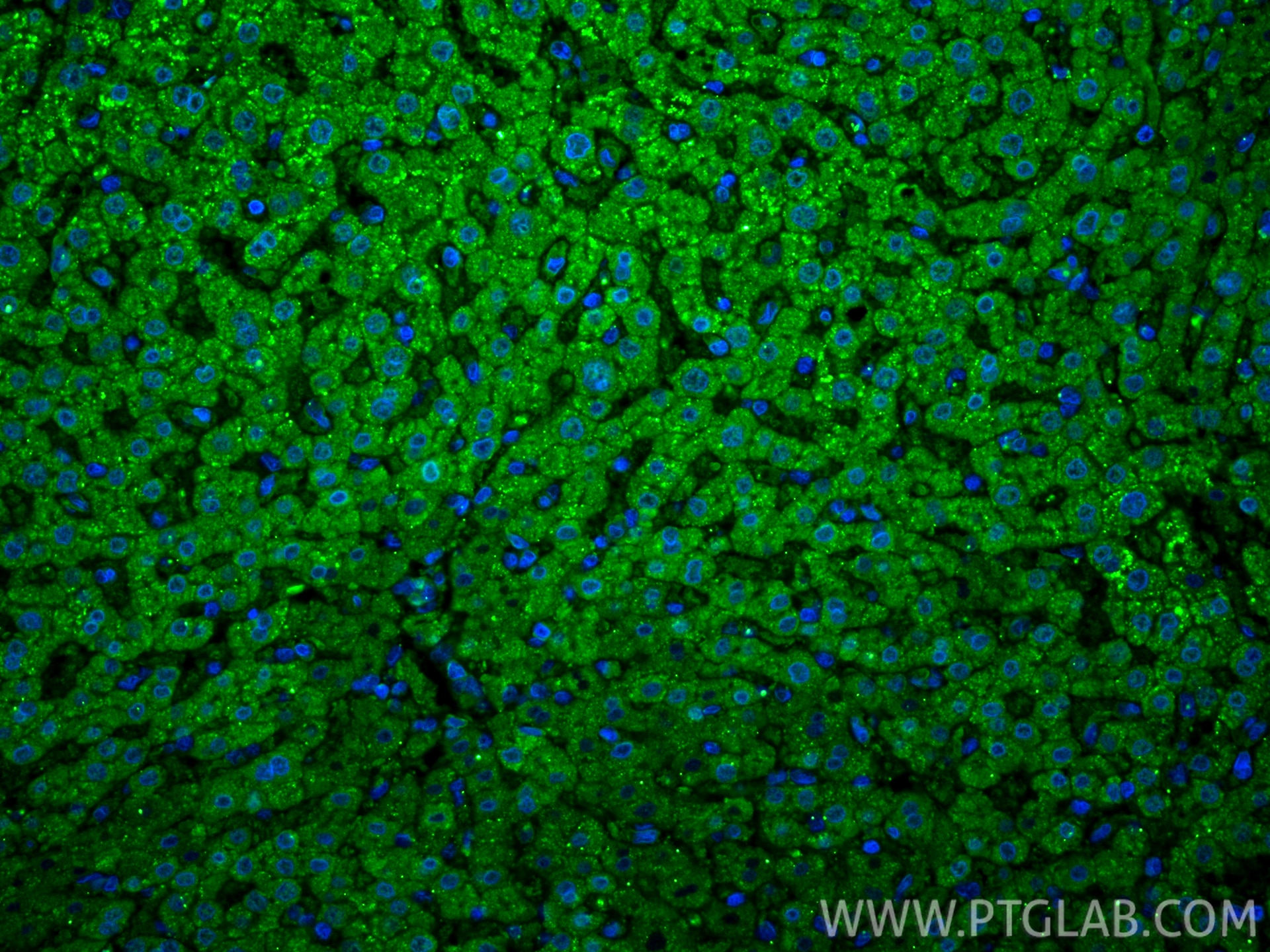 Immunofluorescence (IF) / fluorescent staining of human liver tissue using LACTB2 Monoclonal antibody (67399-1-Ig)
