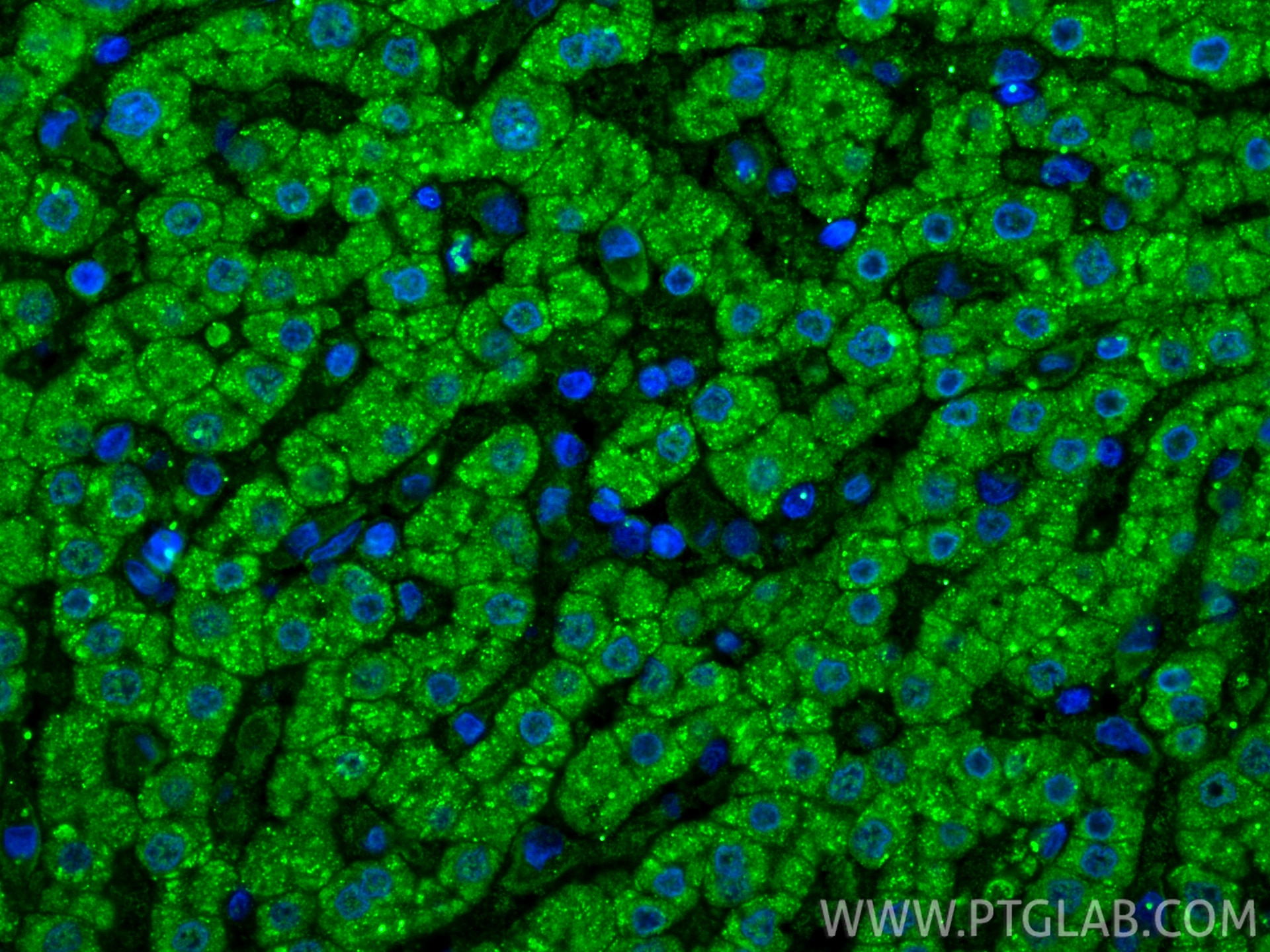 Immunofluorescence (IF) / fluorescent staining of human liver tissue using LACTB2 Monoclonal antibody (67399-1-Ig)