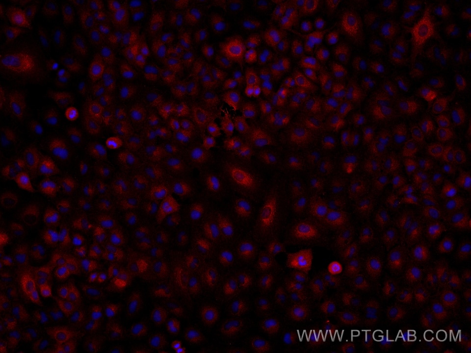 Immunofluorescence (IF) / fluorescent staining of A549 cells using LACTB2 Monoclonal antibody (67399-1-Ig)