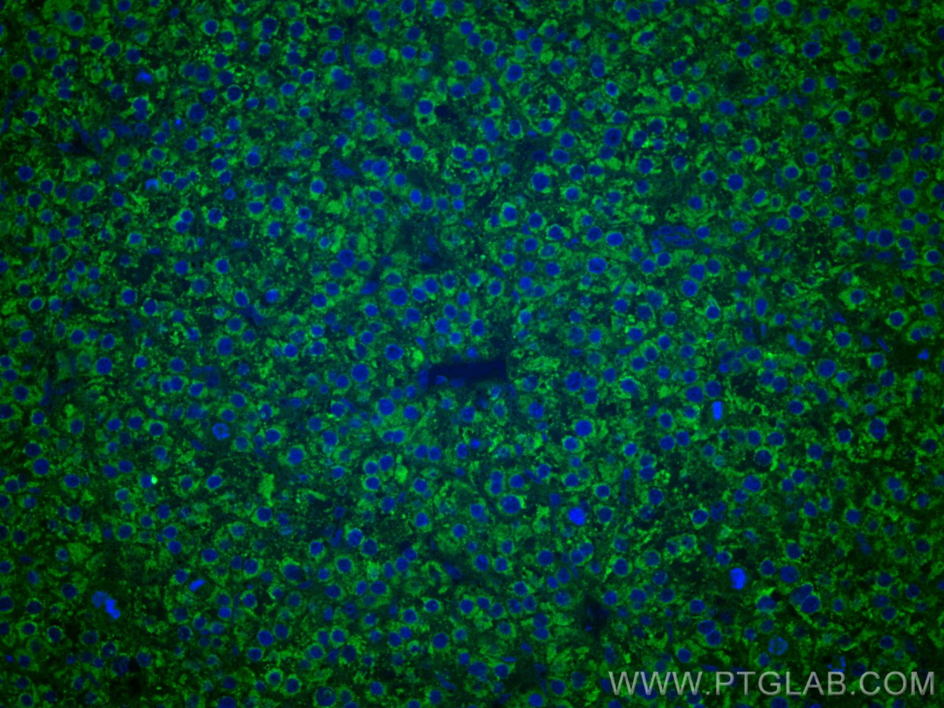 Immunofluorescence (IF) / fluorescent staining of human liver cancer tissue using CoraLite® Plus 488-conjugated LACTB2 Monoclonal an (CL488-67399)