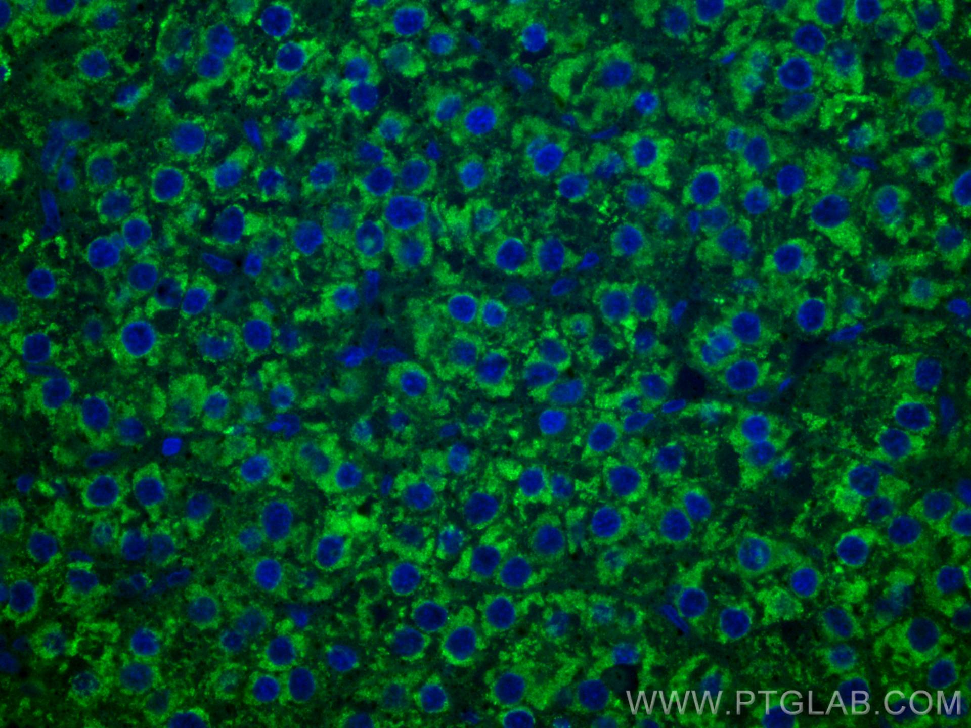 Immunofluorescence (IF) / fluorescent staining of human liver cancer tissue using CoraLite® Plus 488-conjugated LACTB2 Monoclonal an (CL488-67399)