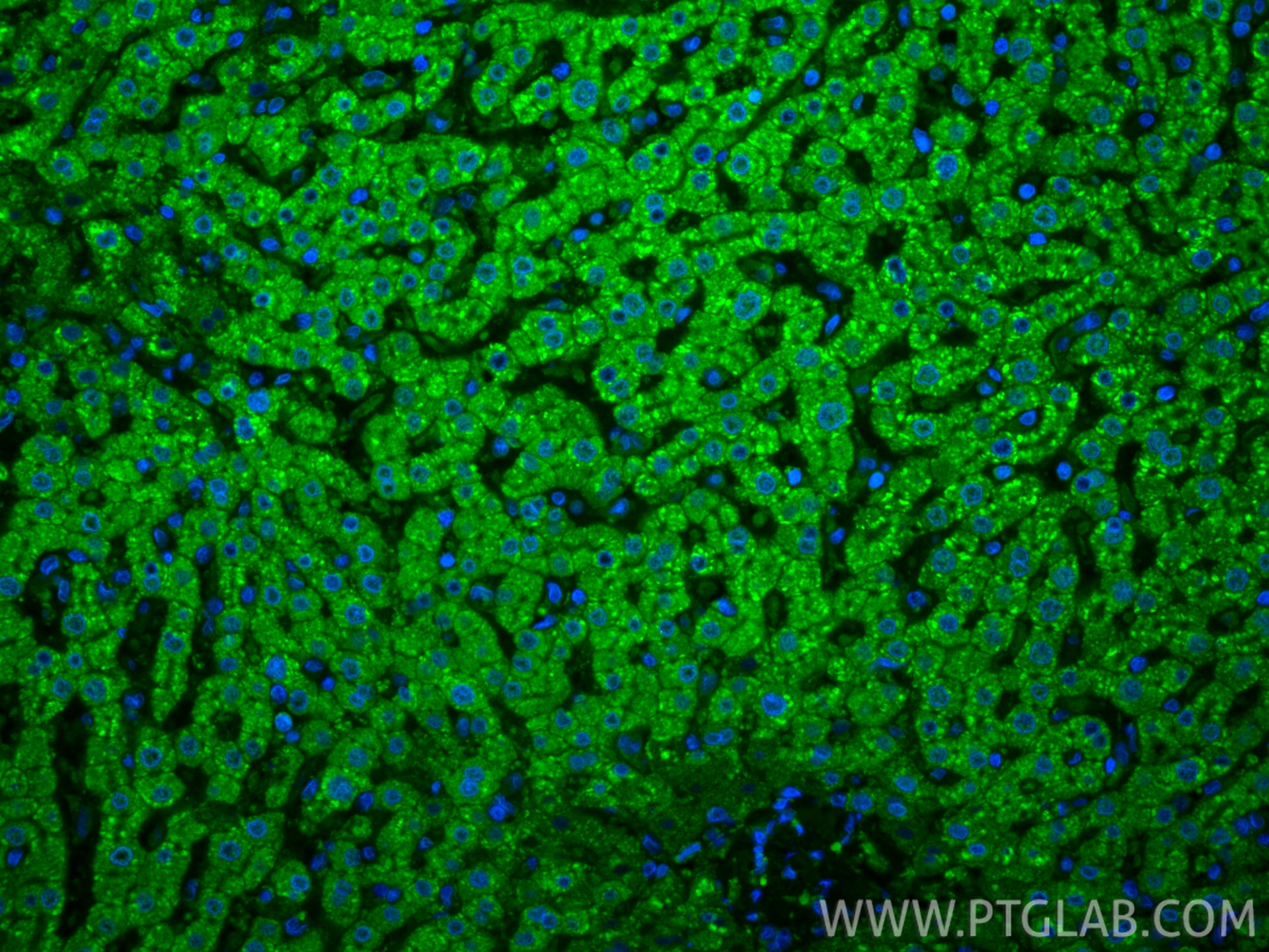 Immunofluorescence (IF) / fluorescent staining of human liver tissue using CoraLite® Plus 488-conjugated LACTB2 Monoclonal an (CL488-67399)