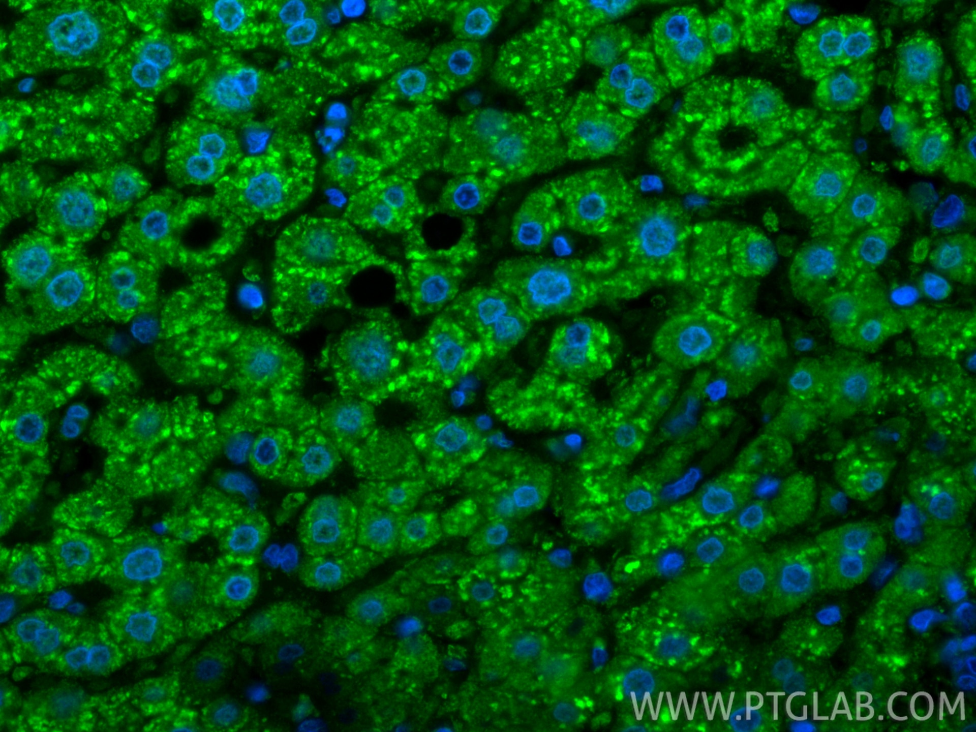 Immunofluorescence (IF) / fluorescent staining of human liver tissue using CoraLite® Plus 488-conjugated LACTB2 Monoclonal an (CL488-67399)
