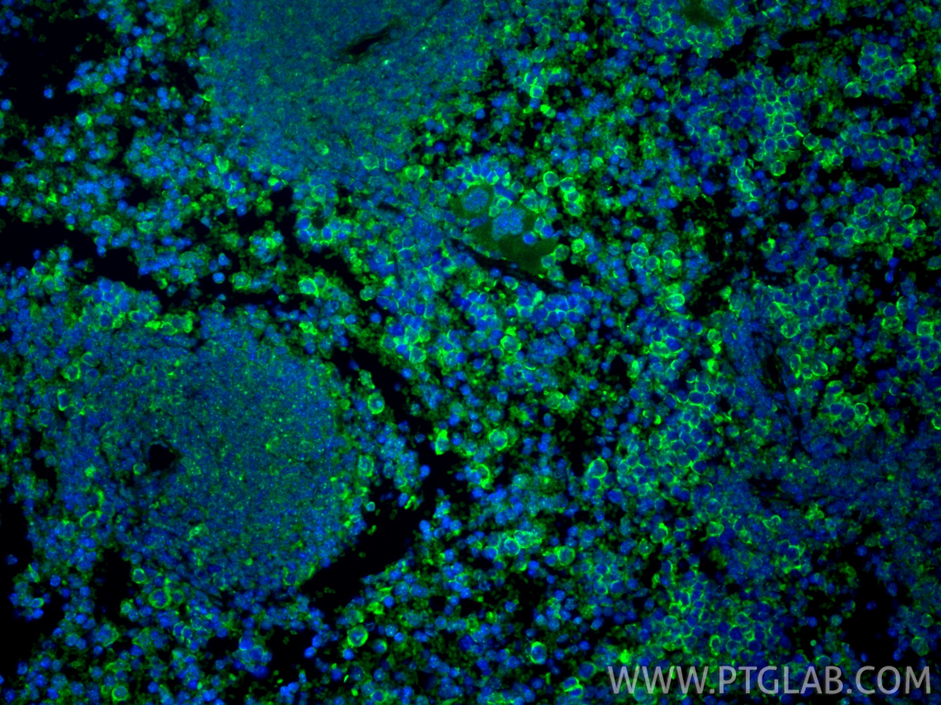 Immunofluorescence (IF) / fluorescent staining of mouse spleen tissue using LAG-3/CD223 Polyclonal antibody (31722-1-AP)