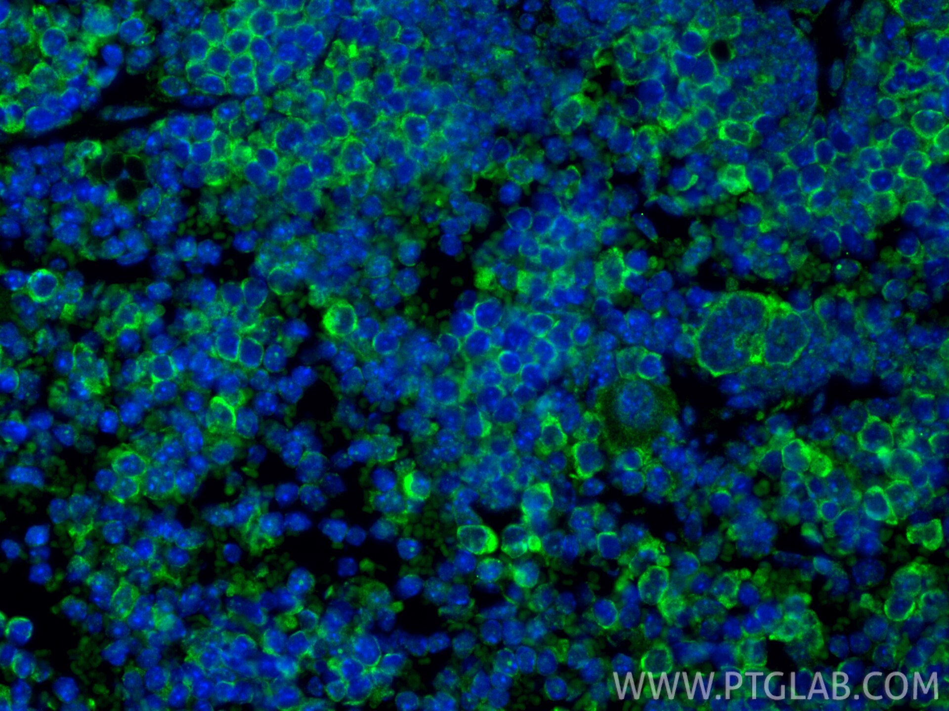 Immunofluorescence (IF) / fluorescent staining of mouse spleen tissue using LAG-3/CD223 Polyclonal antibody (31722-1-AP)