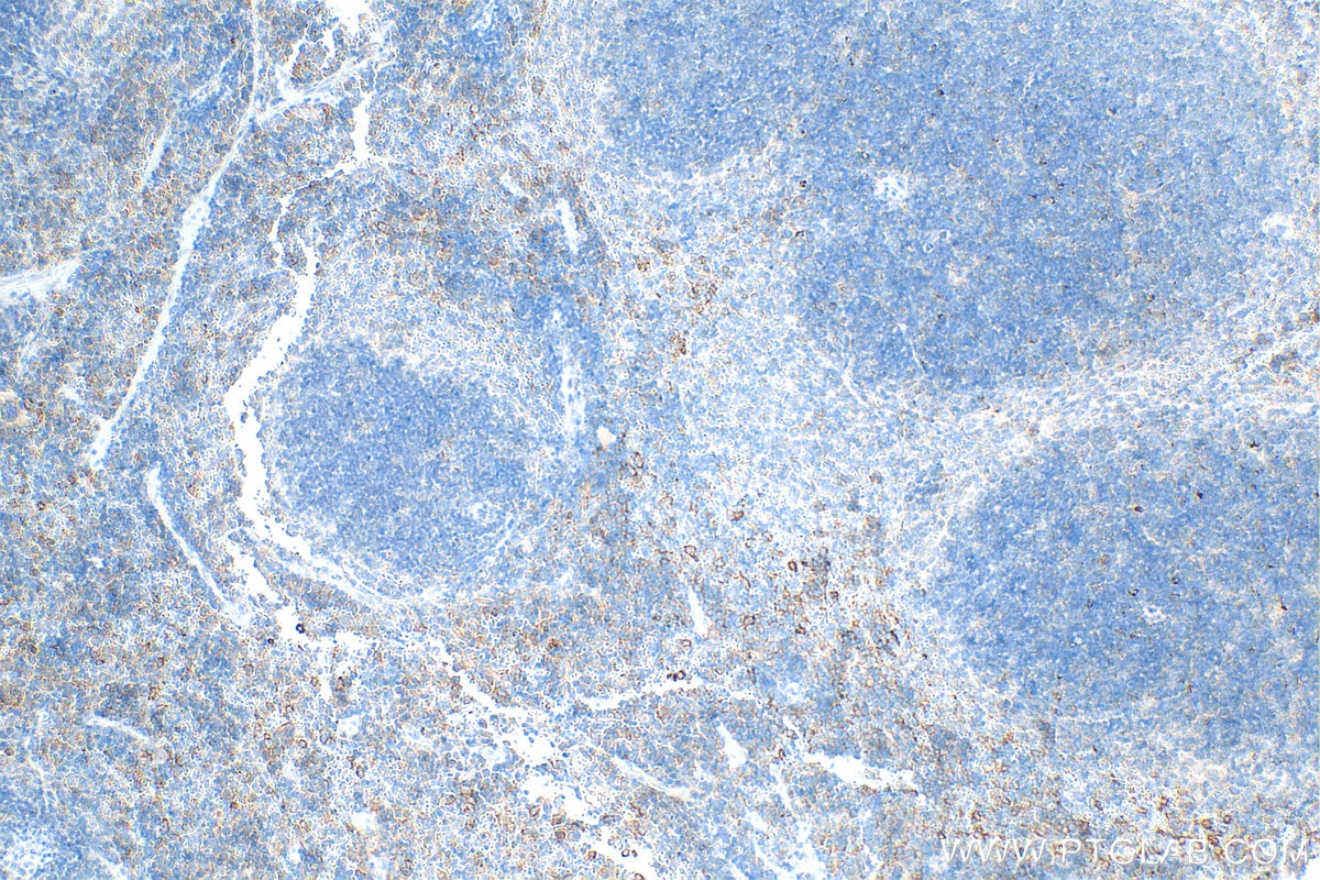 Immunohistochemistry (IHC) staining of mouse spleen tissue using LAG-3/CD223 Polyclonal antibody (31722-1-AP)