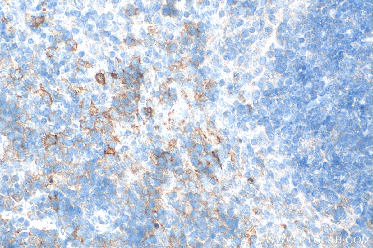 Immunohistochemistry (IHC) staining of mouse spleen tissue using LAG-3/CD223 Polyclonal antibody (31722-1-AP)