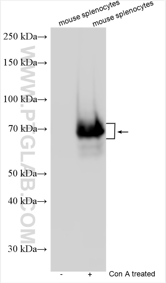 Western Blot (WB) analysis of various lysates using LAG-3/CD223 Polyclonal antibody (31722-1-AP)
