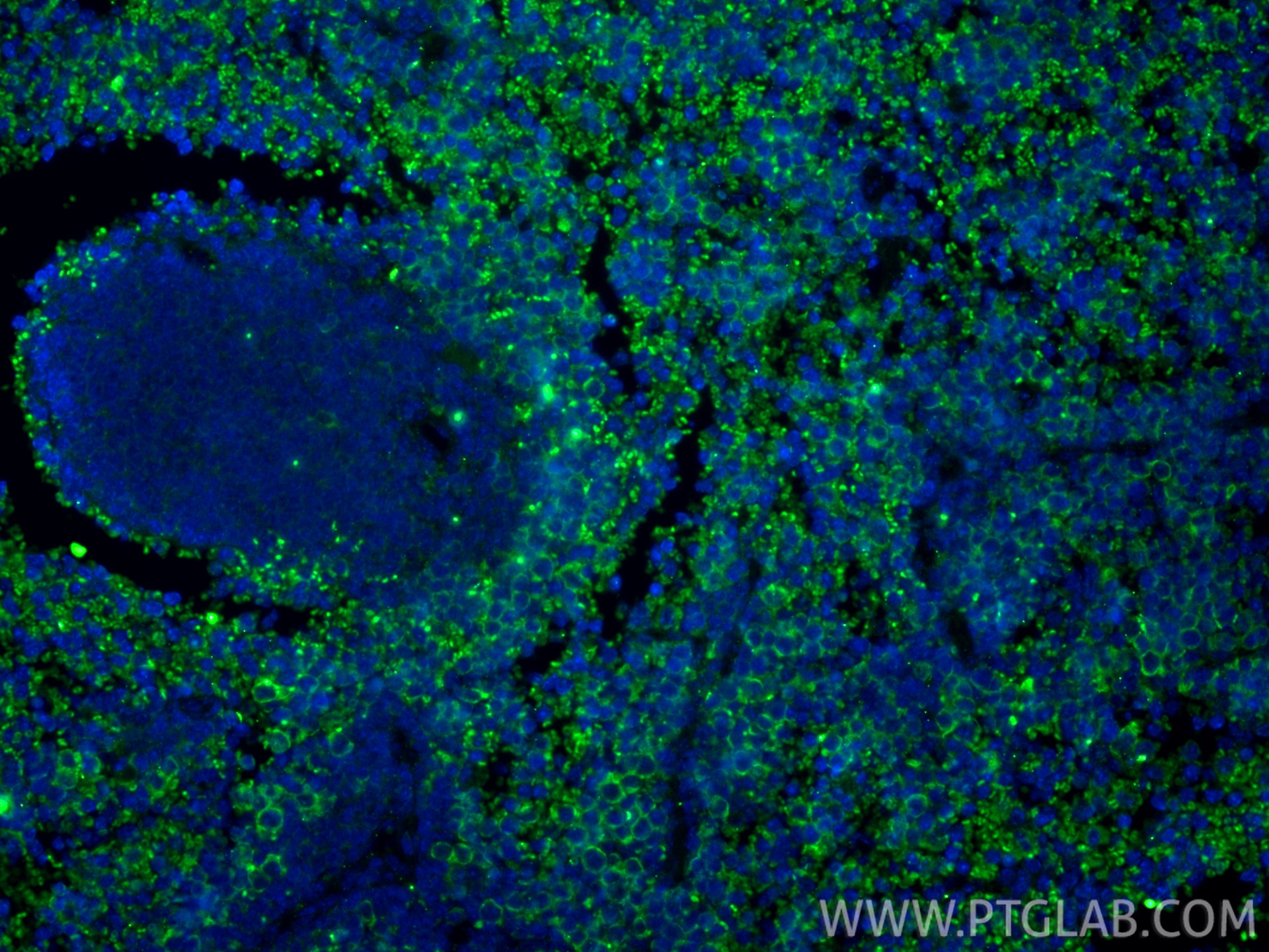 Immunofluorescent analysis of (4% PFA) fixed paraffin-embedded mouse spleen tissue using LAG-3/CD223 antibody (83941-7-RR, Clone: 241007B1 ) at dilution of 1:400 and CoraLite®488-Conjugated Goat Anti-Rabbit IgG(H+L) (SA00013-2). Heat mediated antigen retrieval with Tris-EDTA buffer (pH 9.0). Immunofluorescence (IF) / fluorescent staining of mouse spleen tissue using LAG-3/CD223 Recombinant monoclonal antibody (83941-7-RR)
