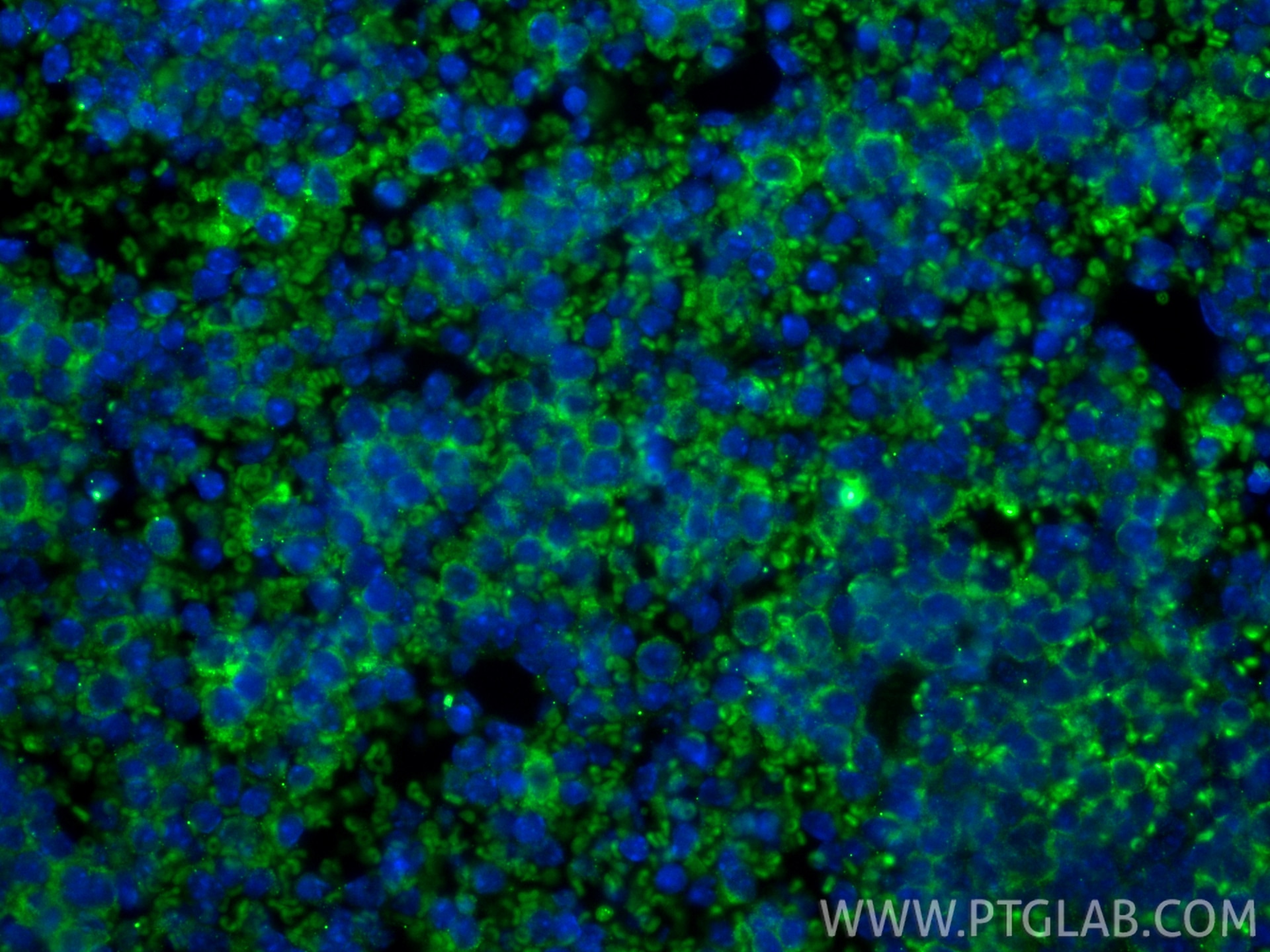 Immunofluorescent analysis of (4% PFA) fixed paraffin-embedded mouse spleen tissue using LAG-3/CD223 antibody (83941-7-RR, Clone: 241007B1 ) at dilution of 1:400 and CoraLite®488-Conjugated Goat Anti-Rabbit IgG(H+L) (SA00013-2). Heat mediated antigen retrieval with Tris-EDTA buffer (pH 9.0). Immunofluorescence (IF) / fluorescent staining of mouse spleen tissue using LAG-3/CD223 Recombinant monoclonal antibody (83941-7-RR)