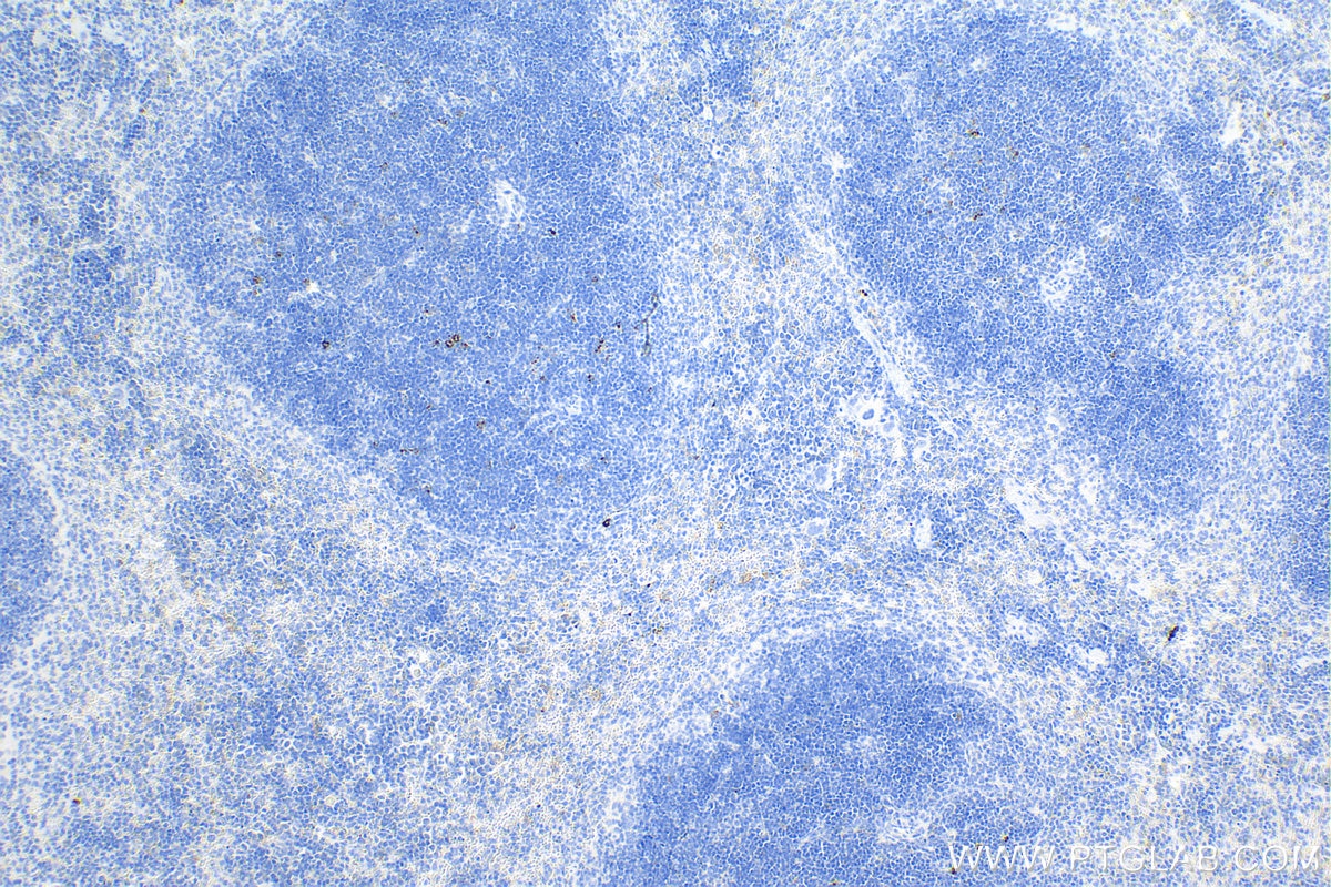 Immunohistochemistry (IHC) staining of mouse spleen tissue using LAG-3/CD223 Recombinant antibody (83941-7-RR)