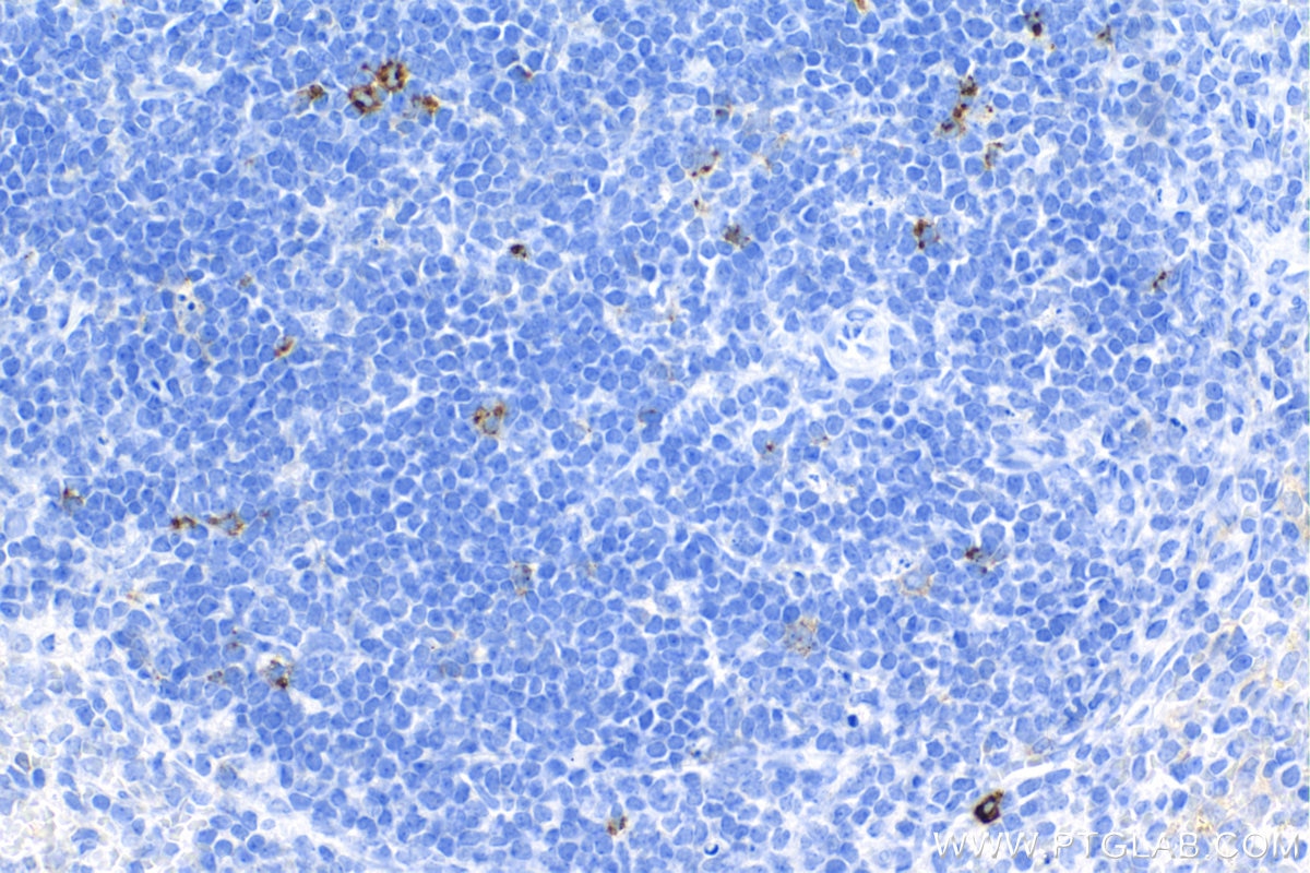 Immunohistochemistry (IHC) staining of mouse spleen tissue using LAG-3/CD223 Recombinant antibody (83941-7-RR)